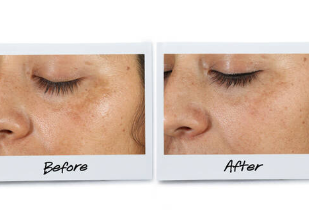 Serum pentru corectarea petelor pigmentare Clearly Corrective Dark Spot Kiehl's